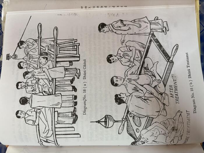 インド パンチャカルマ アーユルヴェーダ 効果　費用　